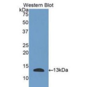 Western blot analysis of the recombinant protein.