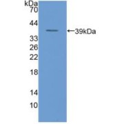 Western blot analysis of recombinant Human uPAR.