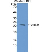 Western blot analysis of the recombinant protein.