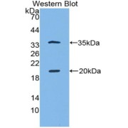 Western blot analysis of the recombinant protein.