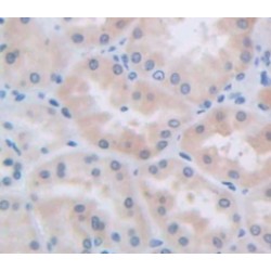 Serine Peptidase Inhibitor Kazal Type 5 (SPINK5) Antibody