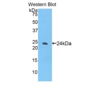 Western blot analysis of the recombinant protein.