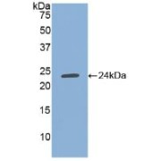 Western blot analysis of recombinant Human TIMP1.