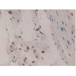 Metalloproteinase Inhibitor 1 (TIMP1) Antibody