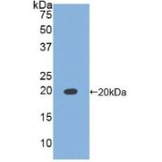 Western blot analysis of recombinant Dog TIMP1.