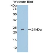 Western blot analysis of the recombinant protein.