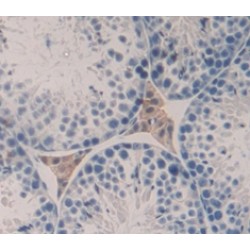 Metalloproteinase Inhibitor 2 (TIMP2) Antibody