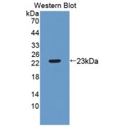 Western blot analysis of the recombinant protein.