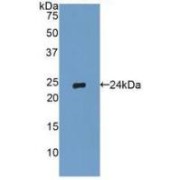 Western blot analysis of recombinant Human TIMP2.