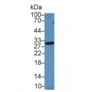 Western blot analysis of Rat Placenta lysate, using Horse TIMP2 Antibody (5 µg/ml) and HRP-conjugated Goat Anti-Rabbit antibody (<a href="https://www.abbexa.com/index.php?route=product/search&amp;search=abx400043" target="_blank">abx400043</a>, 0.2 µg/ml).