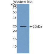 Western blot analysis of the recombinant protein.