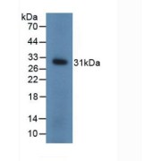 Western blot analysis of recombinant Mouse UCHL1.