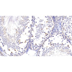 Ubiquitin Carboxyl Terminal Hydrolase L1 (UCHL1) Antibody