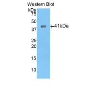 Western blot analysis of the recombinant protein.