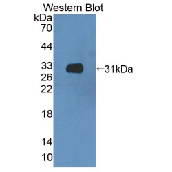 Coiled Coil Domain Containing Protein 60 (CCDC60) Antibody