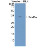 Western blot analysis of the recombinant protein.