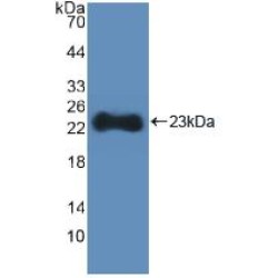 Hydroxymethylglutaryl-CoA Synthase, Cytoplasmic (HMGCS1) Antibody