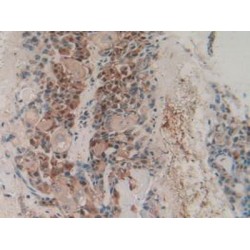 Hydroxymethylglutaryl-CoA Synthase, Cytoplasmic (HMGCS1) Antibody