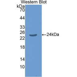 Mothers Against Decapentaplegic Homolog 1 (Smad1) Antibody