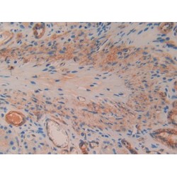 Mothers Against Decapentaplegic Homolog 1 (Smad1) Antibody