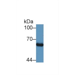 Mothers Against Decapentaplegic Homolog 1 (Smad1) Antibody