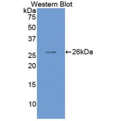 Mothers Against Decapentaplegic Homolog 1 (Smad1) Antibody