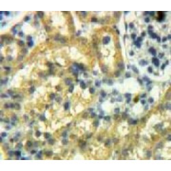 Mothers Against Decapentaplegic Homolog 2 (Smad2) Antibody