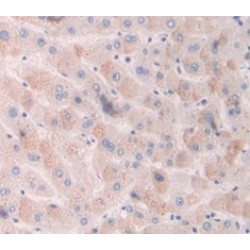 Mothers Against Decapentaplegic Homolog 3 (Smad3) Antibody