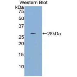 Mothers Against Decapentaplegic Homolog 4 (Smad4) Antibody