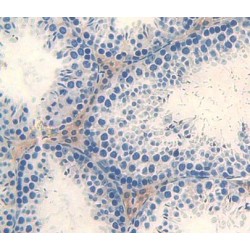 Mothers Against Decapentaplegic Homolog 4 (Smad4) Antibody