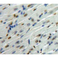 Mothers Against Decapentaplegic Homolog 6 (Smad6) Antibody