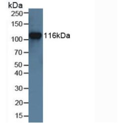 Muscle, Skeletal, Receptor Tyrosine Kinase (MUSK) Antibody