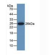 Western blot analysis of recombinant Mouse MUSK.