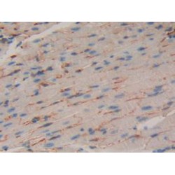 Muscle, Skeletal, Receptor Tyrosine Kinase (MUSK) Antibody