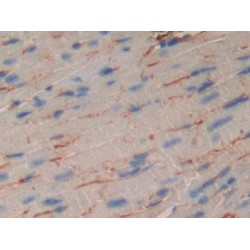 Muscle, Skeletal, Receptor Tyrosine Kinase (MUSK) Antibody