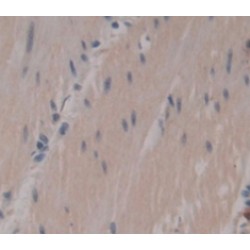 Myosin 7 (MYH7) Antibody