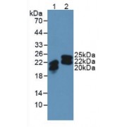 Western blot analysis of (1) Human SW480 Cells and (2) Human Urine.
