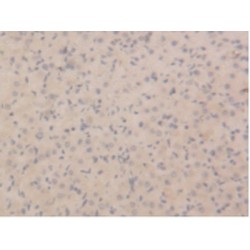 Neutrophil Gelatinase Associated Lipocalin / NGAL (LCN2) Antibody