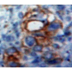 Activated Leukocyte Cell Adhesion Molecule / CD166 (ALCAM) Antibody