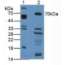 Activated Leukocyte Cell Adhesion Molecule / CD166 (ALCAM) Antibody