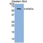 Western blot analysis of recombinant Mouse ALCAM.