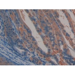 Activated Leukocyte Cell Adhesion Molecule / CD166 (ALCAM) Antibody