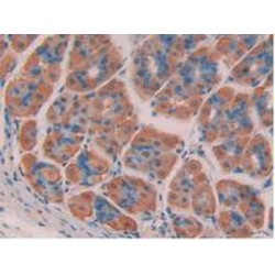 Chromodomain Helicase DNA Binding Protein 3 (CHD3) Antibody