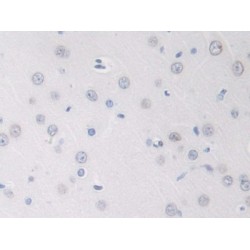 Glial Cell Line Derived Neurotrophic Factor (GDNF) Antibody