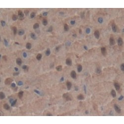 Interleukin 1 Receptor Associated Kinase 2 (IRAK2) Antibody