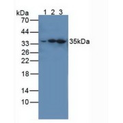 Western blot analysis of (1) Human HeLa cells, (2) Mouse Spleen Tissue and (3) Mouse Brain Tissue.