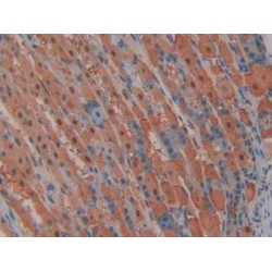 Mitogen-Activated Protein Kinase Kinase 2 (MAP2K2) Antibody