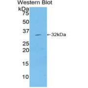 Western blot analysis of the recombinant protein.