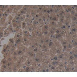 Mitogen-Activated Protein Kinase Kinase 7 (MAP2K7) Antibody