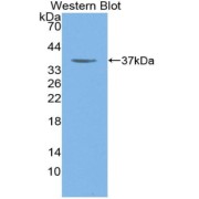 Western blot analysis of the recombinant protein.